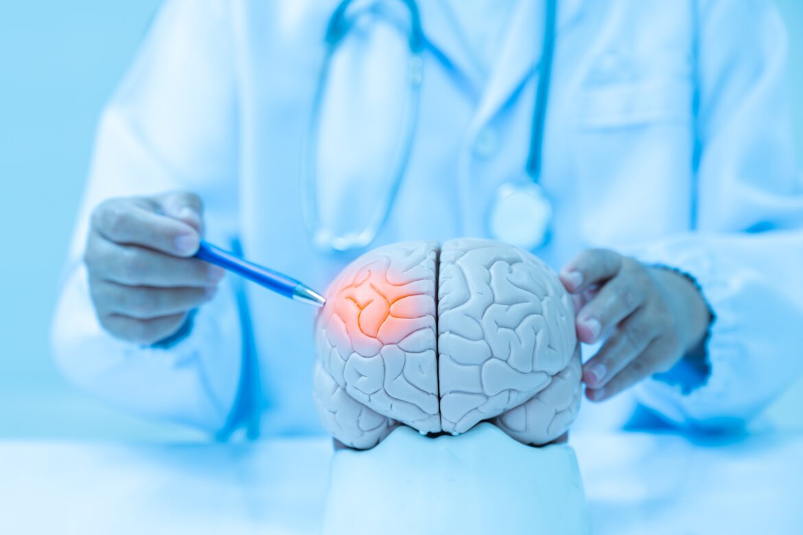 Neurologist,Hand,Pointing,Brain,Anatomy,Human,Model,And,Brain,Disease
