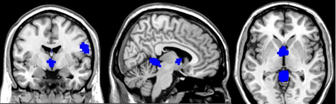 Figure 4B